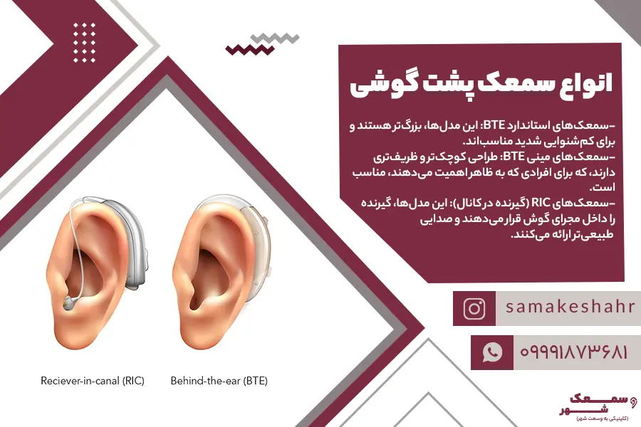 انواع سمعک پشت گوشی از نظر قرار گیری روی گوش